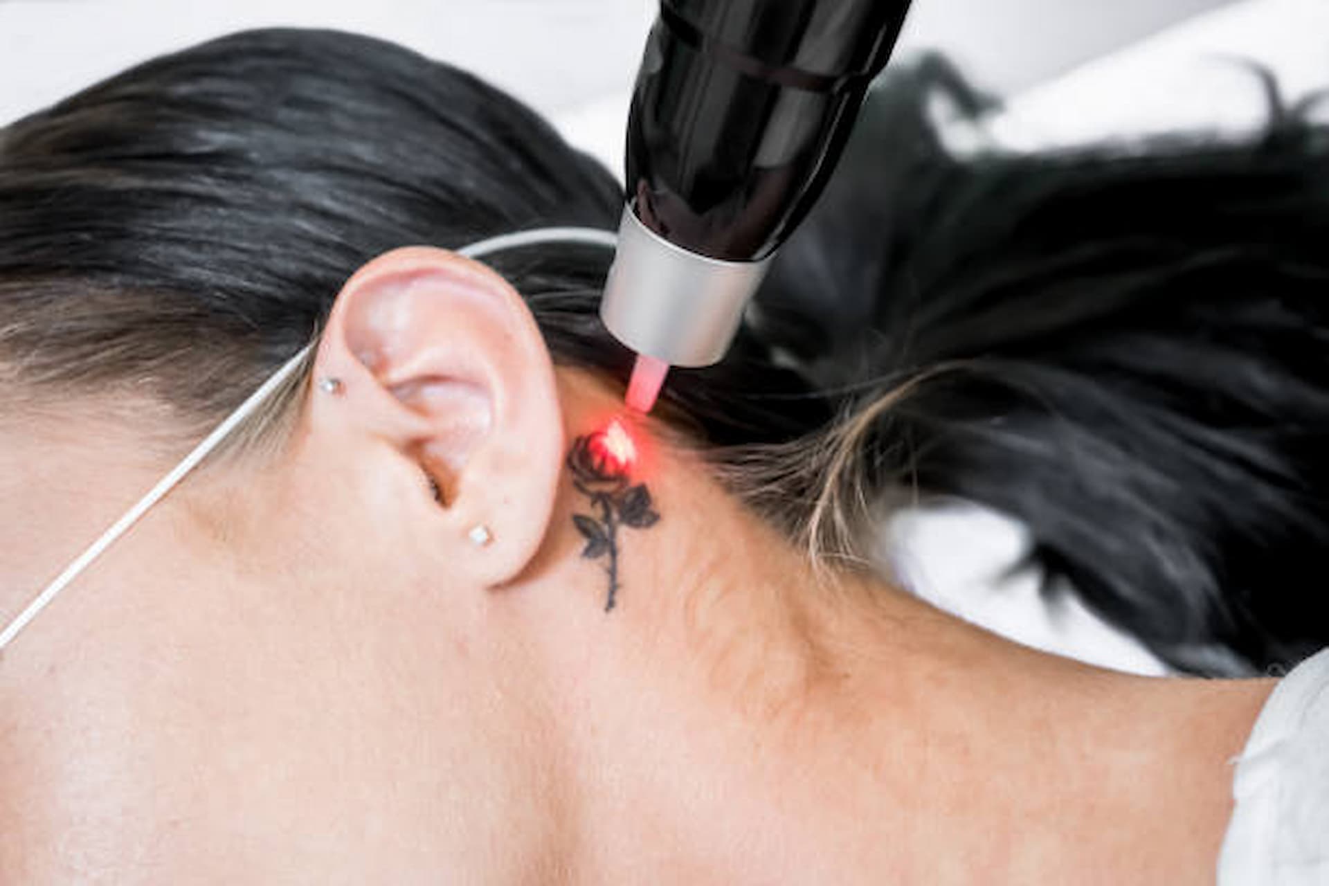 What To Expect During A Laser Tattoo Removal Session